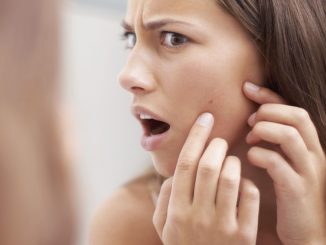 acne skin care canada